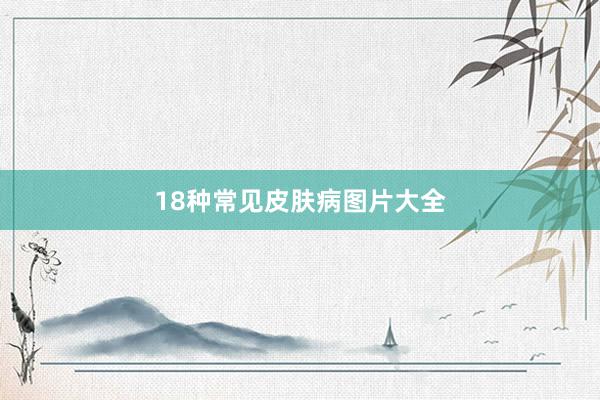 18种常见皮肤病图片大全